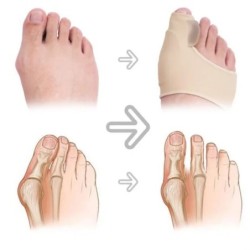 1 pár lábujjleválasztó Hallux Valgus Bunion Corrector Orthotics Lábcsont Hüvelykujj-beállító korrekciós pedikűr zoknikiegyenesít