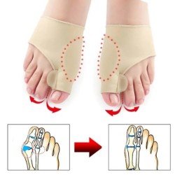 1 pár lábujjleválasztó Hallux Valgus Bunion Corrector Orthotics Lábcsont Hüvelykujj-beállító korrekciós pedikűr zoknikiegyenesít