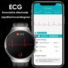 Android IOS Health Monitor Smart Watch készülékhez Férfi pulzusszám EKG+PPG AMOLED 466*466 HD képernyő Bluetooth hívás Smart Wat