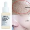 Lactobionic Acid Serum Shrink Pores Moisturizing Essence Folyékony arctisztító póruskezelés Szépségfehérítő krém Bőrápolás