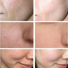 Lactobionic Acid Serum Shrink Pores Moisturizing Essence Folyékony arctisztító póruskezelés Szépségfehérítő krém Bőrápolás