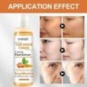 118 ml Tumeric Dark Spots toner Spots Eraser Corrector Kurmeric Fade Blemishes Dark Spot Remover Akne eltávolító tonik sötét bőr