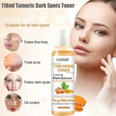 118 ml Tumeric Dark Spots toner Spots Eraser Corrector Kurmeric Fade Blemishes Dark Spot Remover Akne eltávolító tonik sötét bőr