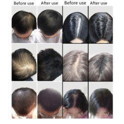 9 Színes Hajszálak Regrowth Porok Keratin Applikátor Hajépítő Rostok Spray Pump Hajnövesztő Termékek Szépség egészség 27,5g