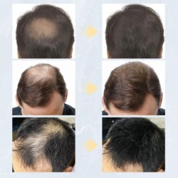 9 Színes Hajszálak Regrowth Porok Keratin Applikátor Hajnövekedési Termékek Permetező Pumpa Fésű Szépség Egészségügyi eszköz