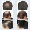 9 Színes Hajszálak Regrowth Porok Keratin Applikátor Hajnövekedési Termékek Permetező Pumpa Fésű Szépség Egészségügyi eszköz